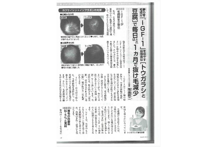 円形脱毛症　病院